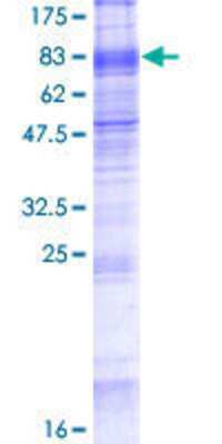 12.5% SDS-PAGE Stained with Coomassie Blue.