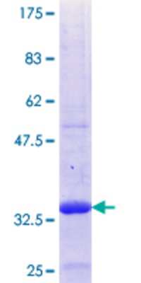 12.5% SDS-PAGE Stained with Coomassie Blue.