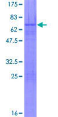 12.5% SDS-PAGE Stained with Coomassie Blue.