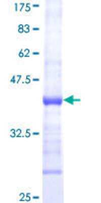 Recombinant Human CTL1/SLC44A1 GST (N-Term) Protein (H00023446-Q01 ...