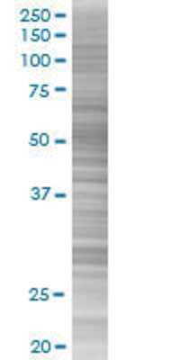 CBX6 transfected lysate.