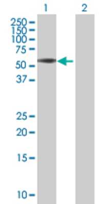 Lane 1: CBX6 transfected lysate (45.43 KDa) Lane 2: Non-transfected lysate.