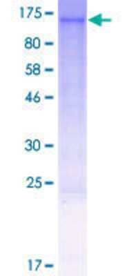 12.5% SDS-PAGE Stained with Coomassie Blue.