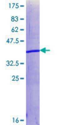 SDS-PAGE Recombinant Human SUZ12 GST (N-Term) Protein