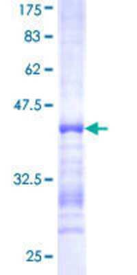 12.5% SDS-PAGE Stained with Coomassie Blue.