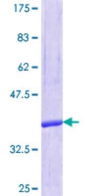 12.5% SDS-PAGE Stained with Coomassie Blue.