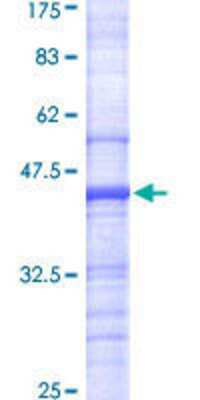 12.5% SDS-PAGE Stained with Coomassie Blue.