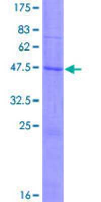 SDS-Page: Recombinant Human Claudin-14 Protein [H00023562-P01] - 12.5% SDS-PAGE Stained with Coomassie Blue.