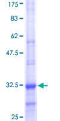12.5% SDS-PAGE Stained with Coomassie Blue.