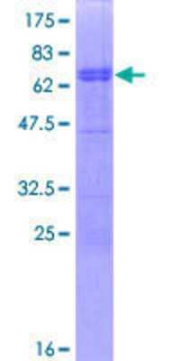 12.5% SDS-PAGE Stained with Coomassie Blue.