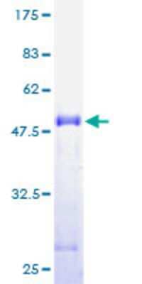 Other Recombinant Human CGI-16 GST (N-Term) Protein