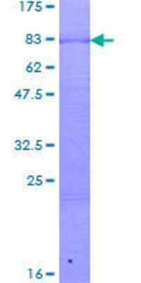 12.5% SDS-PAGE Stained with Coomassie Blue.