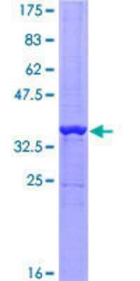 12.5% SDS-PAGE Stained with Coomassie Blue.