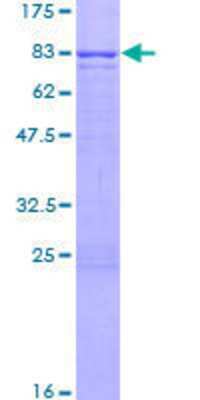 12.5% SDS-PAGE Stained with Coomassie Blue.