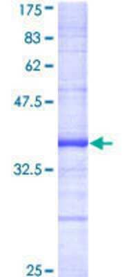 Other Recombinant Human DAP Kinase 2 GST (N-Term) Protein