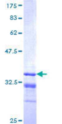 12.5% SDS-PAGE Stained with Coomassie Blue.