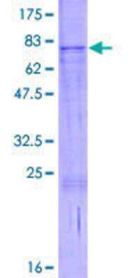 SDS-Page: Recombinant Human RUSC1 Protein [H00023623-P01] - 12.5% SDS-PAGE Stained with Coomassie Blue.