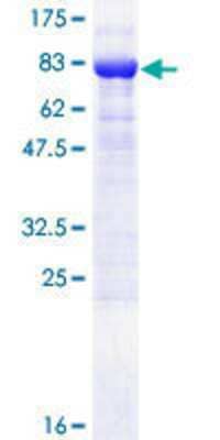 12.5% SDS-PAGE Stained with Coomassie Blue.