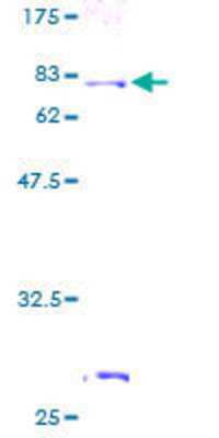 12.5% SDS-PAGE Stained with Coomassie Blue.
