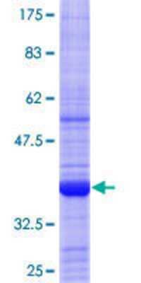 SDS-Page: Recombinant Human AIPL1 Protein [H00023746-Q01] - 12.5% SDS-PAGE Stained with Coomassie Blue.