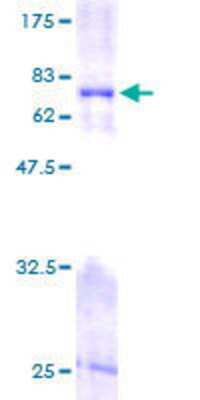 12.5% SDS-PAGE Stained with Coomassie Blue.