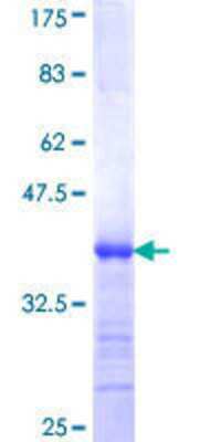SDS-Page: Recombinant Human POTEH Protein [H00023784-Q01] - 12.5% SDS-PAGE Stained with Coomassie Blue.