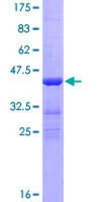 12.5% SDS-PAGE Stained with Coomassie Blue.