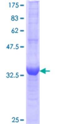12.5% SDS-PAGE Stained with Coomassie Blue.
