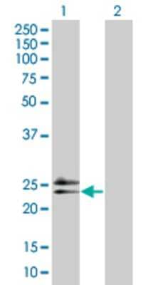 Lane 1: RAD54B transfected lysate (18.6 KDa) Lane 2: Non-transfected lysate.