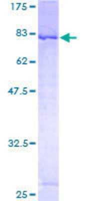 12.5% SDS-PAGE Stained with Coomassie Blue.