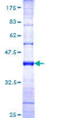 12.5% SDS-PAGE Stained with Coomassie Blue.