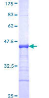 12.5% SDS-PAGE Stained with Coomassie Blue.
