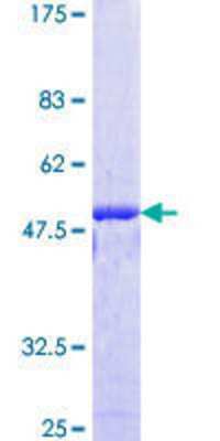 12.5% SDS-PAGE Stained with Coomassie Blue.