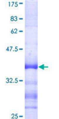 12.5% SDS-PAGE Stained with Coomassie Blue.