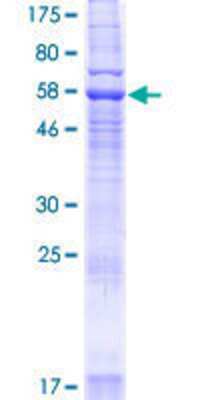 SDS-PAGE Recombinant Human YIPF3 GST (N-Term) Protein