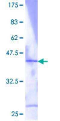 SDS-PAGE Recombinant Human RPL36 GST (N-Term) Protein