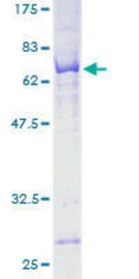 12.5% SDS-PAGE Stained with Coomassie Blue.