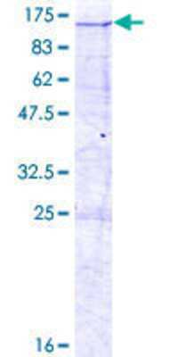 SDS-Page: Recombinant Human DKFZP434B168 Protein [H00025896-P01] - 12.5% SDS-PAGE Stained with Coomassie Blue.