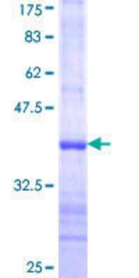 12.5% SDS-PAGE Stained with Coomassie Blue.