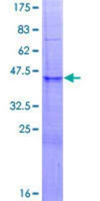 SDS-Page: Recombinant Human SIN3A Protein [H00025942-P01] - 12.5% SDS-PAGE Stained with Coomassie Blue.