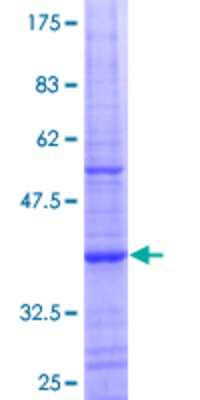 12.5% SDS-PAGE Stained with Coomassie Blue.