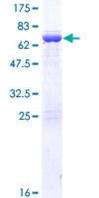 12.5% SDS-PAGE Stained with Coomassie Blue.