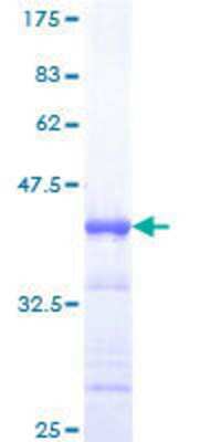 12.5% SDS-PAGE Stained with Coomassie Blue.