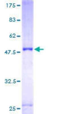 12.5% SDS-PAGE Stained with Coomassie Blue.