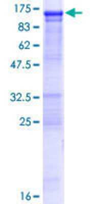 SDS-Page: Recombinant Human OSBPL3 Protein [H00026031-P01] - 12.5% SDS-PAGE Stained with Coomassie Blue.