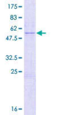 12.5% SDS-PAGE Stained with Coomassie Blue.