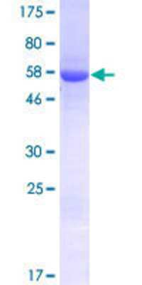 Other Recombinant Human UBXN7 GST (N-Term) Protein