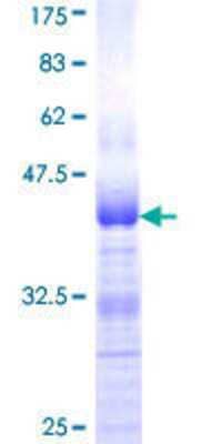 12.5% SDS-PAGE Stained with Coomassie Blue.