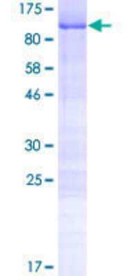 SDS-Page: Recombinant Human CCDC9 Protein [H00026093-P01] - 12.5% SDS-PAGE Stained with Coomassie Blue.