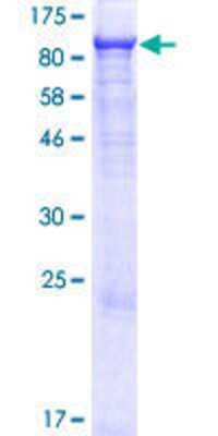 12.5% SDS-PAGE Stained with Coomassie Blue.